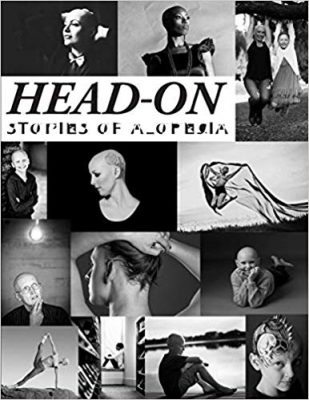 HEAD ON – Stories of Alopecia by Deeann Callis Graham – Self-Esteem, Success Self-Help, Dermatology